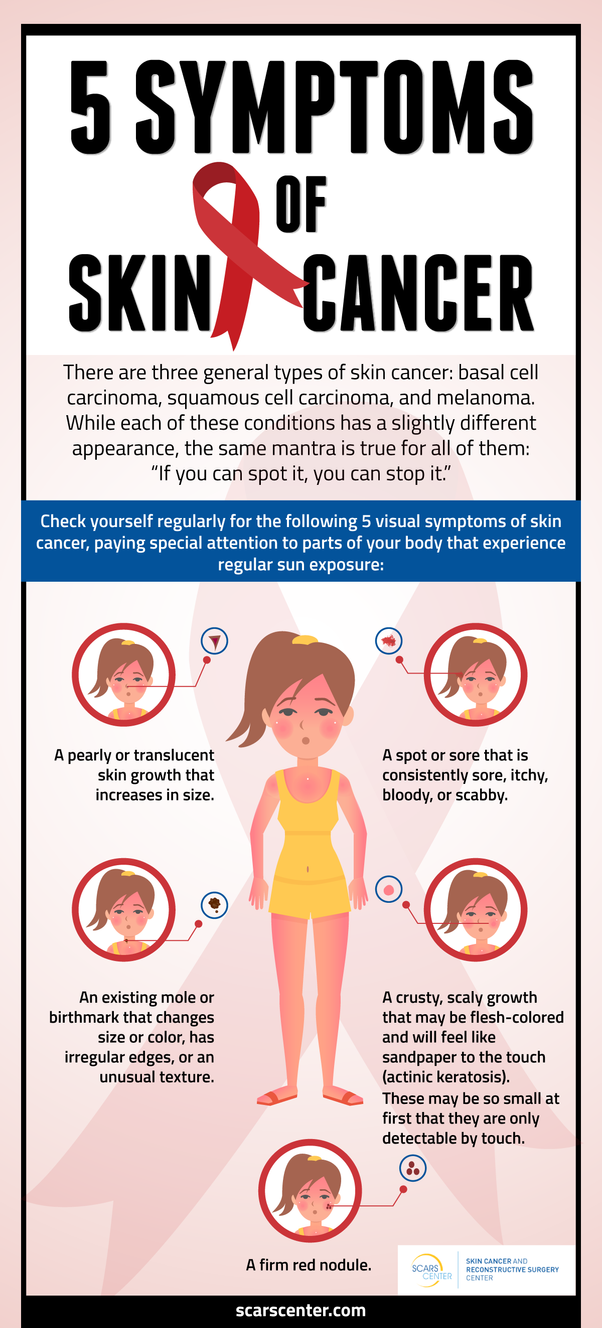 5 Symptoms Of Skin Cancer By Skarscenter16 On Deviantart